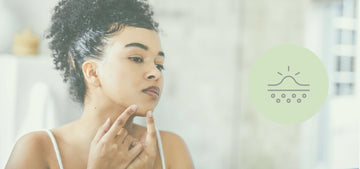 mia pelle, miapelle, acne blemishes, anti-acne, treatment for acne