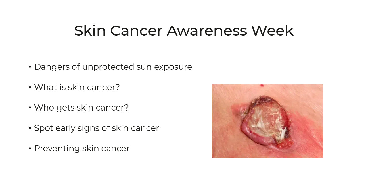 Skin Cancer Awareness Week